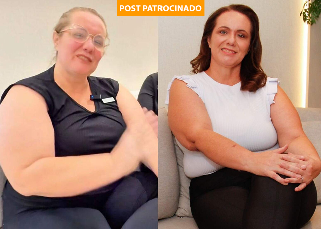 Cris emagrece na Cl&iacute;nica Acqua e reencontra autoestima aos 47 anos