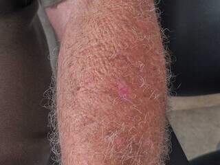 Mutirão reúne centenas e reforça alerta sobre câncer mais frequente do país Mutirão reúne centenas e reforça alerta sobre câncer mais frequente do país