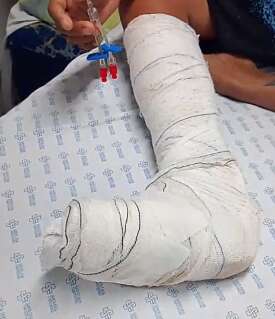 Internado h&aacute; cinco dias, paciente com esquizofrenia espera cirurgia