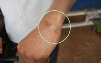 Munic&iacute;pios chegaram a pagar R$ 27 mil para cl&iacute;nica que torturava pacientes