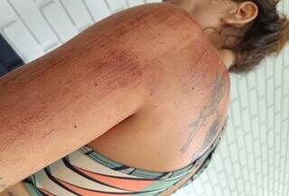 Bab&aacute; e menina de 2 anos s&atilde;o arrastadas por motorista de aplicativo