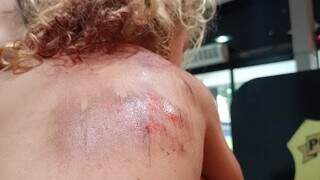 Bab&aacute; e menina de 2 anos s&atilde;o arrastadas por motorista de aplicativo