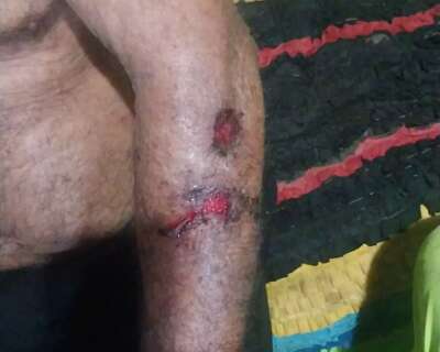 Usu&aacute;ria de drogas que esfaqueou idoso volta para "terminar o servi&ccedil;o" e &eacute; presa