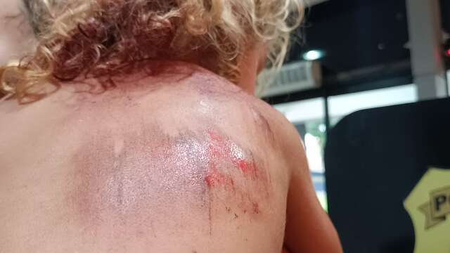 Bab&aacute; e menina de 2 anos s&atilde;o arrastadas por motorista de aplicativo