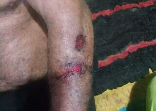 Usu&aacute;ria de drogas que esfaqueou idoso volta para "terminar o servi&ccedil;o" e &eacute; presa