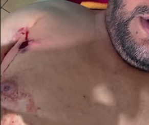 Tiros confundidos com fogos deixam dois baleados em conveni&ecirc;ncia