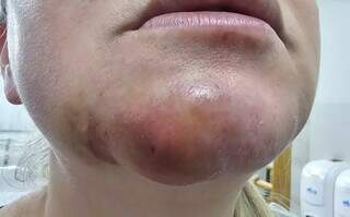 Cliente processa cl&iacute;nica de est&eacute;ticas ap&oacute;s uma bact&eacute;ria deformar o rosto 