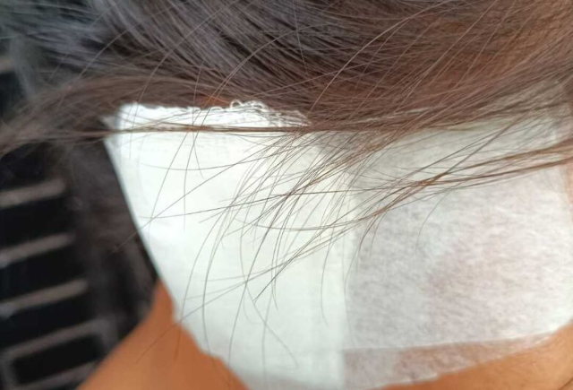 Mulher tem parte da orelha arrancada em mordida do companheiro