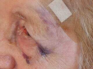 Idosa agredida em roubo &eacute; mais um caso que assusta moradores da Vila Sobrinho