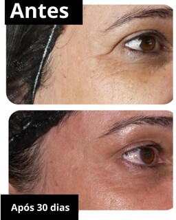 Refer&ecirc;ncia em tecnologia, cl&iacute;nica inova com laser &iacute;ntimo feminino