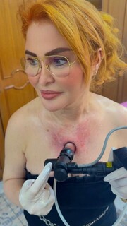 Refer&ecirc;ncia em tecnologia, cl&iacute;nica inova com laser &iacute;ntimo feminino