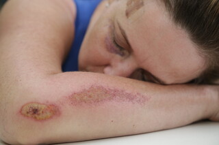 Nos primeiros dez dias do ano, quase 500 mulheres sofreram violência doméstica Nos primeiros dez dias do ano, quase 500 mulheres sofreram violência doméstica