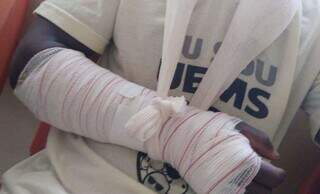 Motociclista é indenizado em R$ 10 mil após cair em buraco aberto no asfalto Motociclista é indenizado em R$ 10 mil após cair em buraco aberto no asfalto