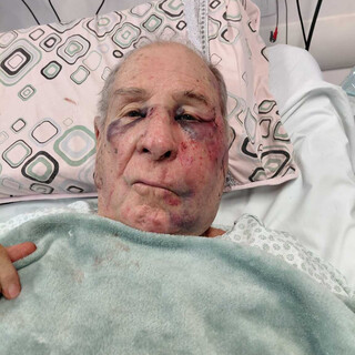 Com agressor solto, fam&iacute;lia pede justi&ccedil;a pela morte de idoso espancado em casa