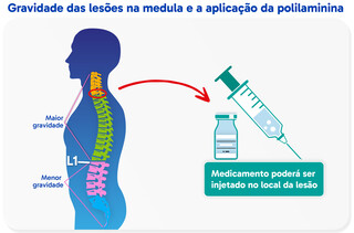 Com polilaminina em estudo, m&eacute;dicos falam da evolu&ccedil;&atilde;o em tratamento de les&otilde;es 