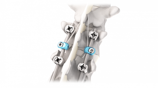 Com polilaminina em estudo, m&eacute;dicos falam da evolu&ccedil;&atilde;o em tratamento de les&otilde;es 