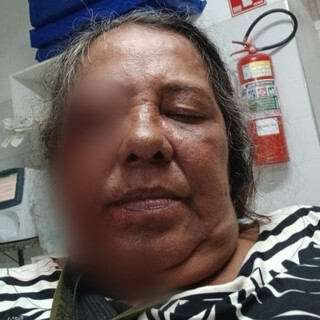 Florista &eacute; atingida por estilha&ccedil;os de bomba da PM e pode perder a vis&atilde;o