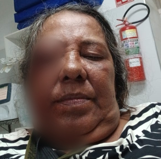 Florista ferida por estilha&ccedil;o de bomba contesta vers&atilde;o de ataque a policiais