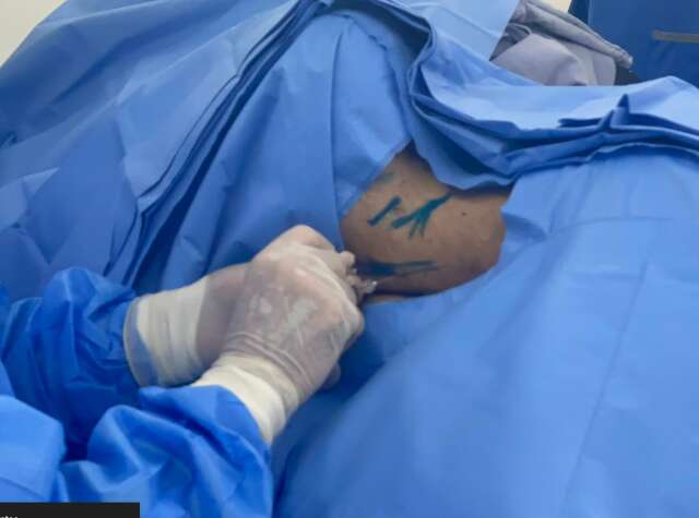 Ap&oacute;s cirurgia, esperan&ccedil;a &eacute; militar tetrapl&eacute;gico recuperar movimentos aos poucos