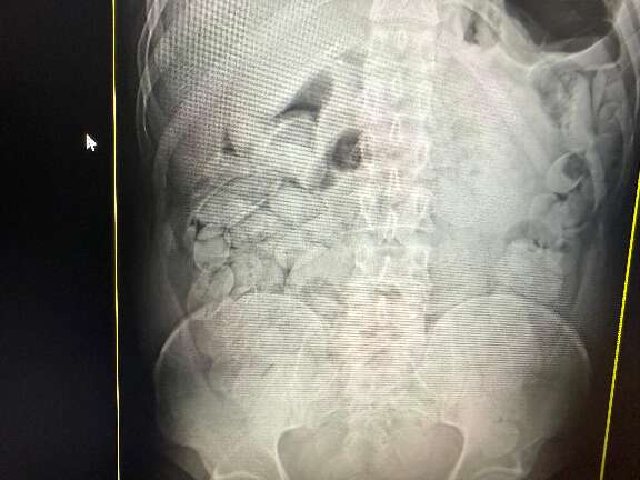 MS j&aacute; prendeu 23 bolivianos na "rota dos engolidores" que leva droga at&eacute; SP