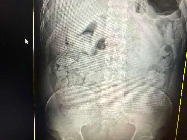 MS j&aacute; prendeu 23 bolivianos na "rota dos engolidores" que leva droga at&eacute; SP