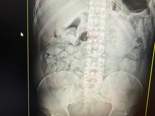 Opera&ccedil;&atilde;o intercepta 4 &ocirc;nibus com 18 mulas do tr&aacute;fico e R$ 1 milh&atilde;o em coca&iacute;na