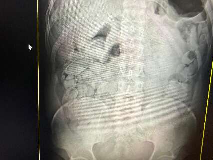 MS j&aacute; prendeu 23 bolivianos na "rota dos engolidores" que leva droga at&eacute; SP