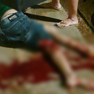 Colis&atilde;o entre motos deixa jovem com fratura exposta no Campo Alto