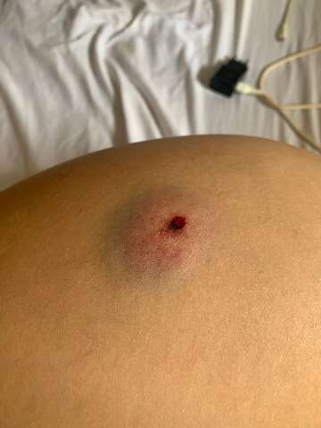 "Pavor&rdquo;, diz jovem atingida por tiro de chumbinho por motorista de aplicativo