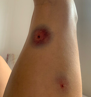 &ldquo;Pavor&rdquo;, relata jovem baleada com chumbinho por motorista de aplicativo