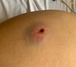 &ldquo;Pavor&rdquo;, relata jovem baleada com chumbinho por motorista de aplicativo