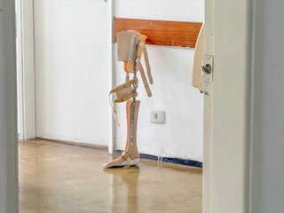 &ldquo;O pior &eacute; ter que esperar&rdquo;, diz quem demorou anos para receber pr&oacute;tese do INSS