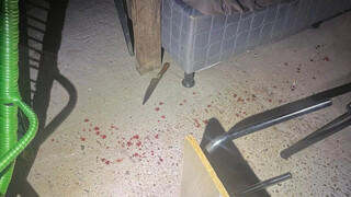 Mulher esfaqueia companheiro no rosto e alega ter sido agredida