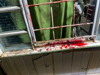 Mulher esfaqueia companheiro no rosto e alega ter sido agredida