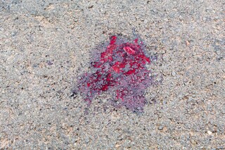 Motoentregador morre ao cair na pista e ser atropelado por caminh&atilde;o