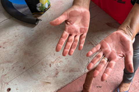 Poeira de min&eacute;rio causa problemas de sa&uacute;de em ribeirinhos de Corumb&aacute;