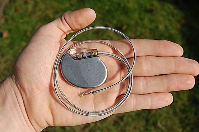 Falta de marcapasso coloca Sa&uacute;de no radar de Defensoria