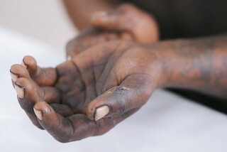 No Marcos Roberto, igreja acolhe quem vive na rua com banho e caf&eacute; quente