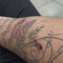 Corrida por aplicativo termina em agress&atilde;o, mordida e celular arremessado