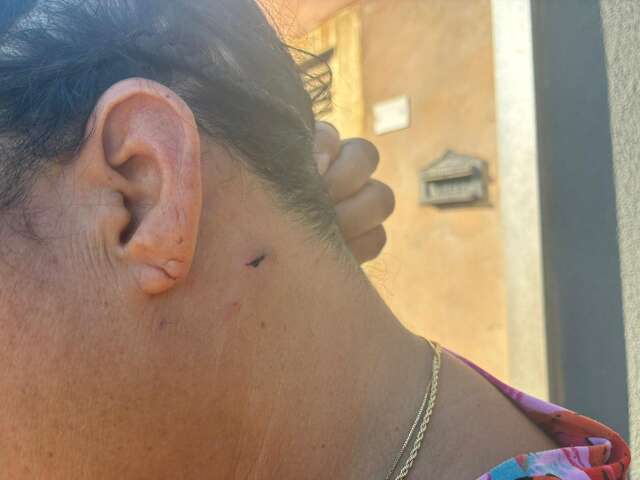 &ldquo;Parecia fogos, n&atilde;o parava&rdquo;, diz v&iacute;tima de ataque com mais de 15 tiros