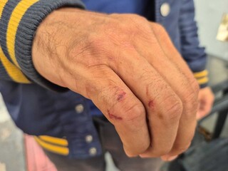 Motoboy leva mata-leão em discussão com passageiro: "sem motivo" Motoboy leva mata-leão em discussão com passageiro: "sem motivo"