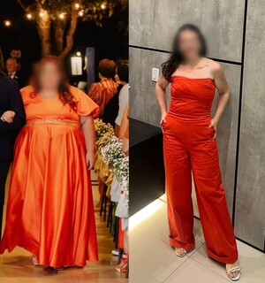 Obesidade e lipedema t&ecirc;m tratamento; diagn&oacute;stico precoce ajuda