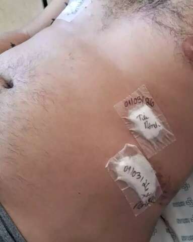 Homem esfaqueado no Estrela do Sul aguarda h&aacute; 7 dias por cirurgia na Santa Casa