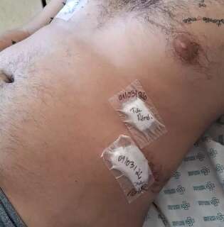 Homem esfaqueado no Estrela do Sul aguarda h&aacute; 7 dias por cirurgia na Santa Casa