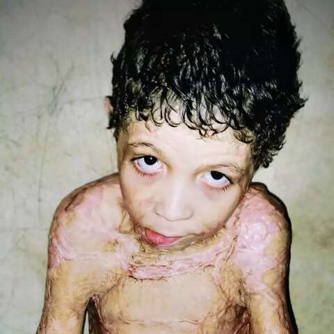 Ap&oacute;s explos&atilde;o, sonho de menino &eacute; &ldquo;voltar ao normal e estudar&rdquo;