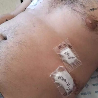 Homem esfaqueado no Estrela do Sul aguarda há 7 dias por cirurgia na Santa Casa Homem esfaqueado no Estrela do Sul aguarda há 7 dias por cirurgia na Santa Casa
