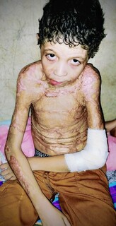 Ap&oacute;s explos&atilde;o, sonho de menino &eacute; &ldquo;voltar ao normal e estudar&rdquo;