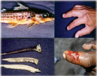 Pouco conhecidos, peixes pe&ccedil;onhentos podem ajudar na descoberta de medicamentos