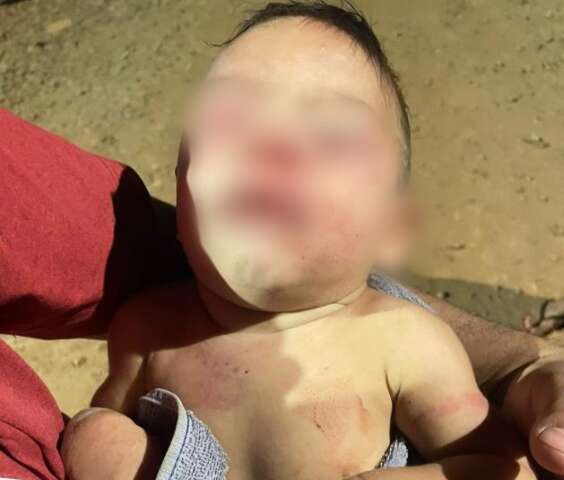 Pai &eacute; preso ap&oacute;s espancar beb&ecirc; de 4 meses enquanto m&atilde;e trabalhava