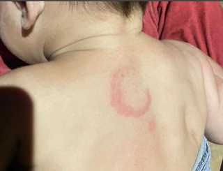 Preso por espancar bebê já havia sido detido por agredir companheira grávida Preso por espancar bebê já havia sido detido por agredir companheira grávida